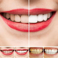 SP4 Ultra Brightening Toothpaste for Stain Removal and Enamel Protection (BUY 1 GET 1 FREE)